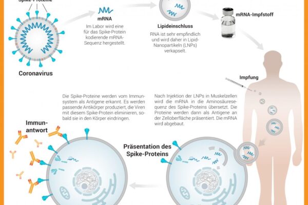 Fortschritt beim mRNA-Transport ins Gehirn durch Lipid-Nanopartikel